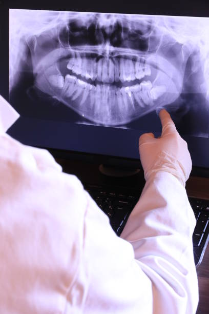 Best Emergency Root Canal Treatment in Ferris, TX
