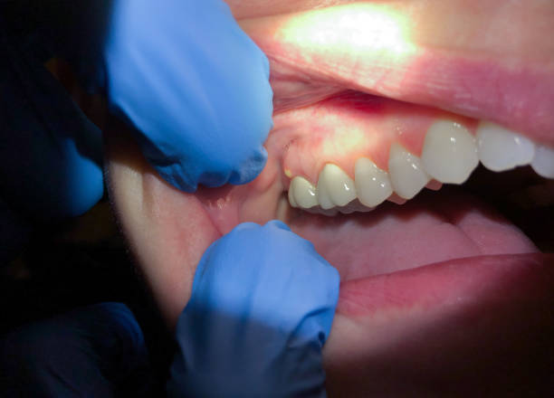 Best Same-Day Emergency Dentist in Ferris, TX